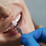 single-tooth-implant-vs-dental-bridge-which-is-better